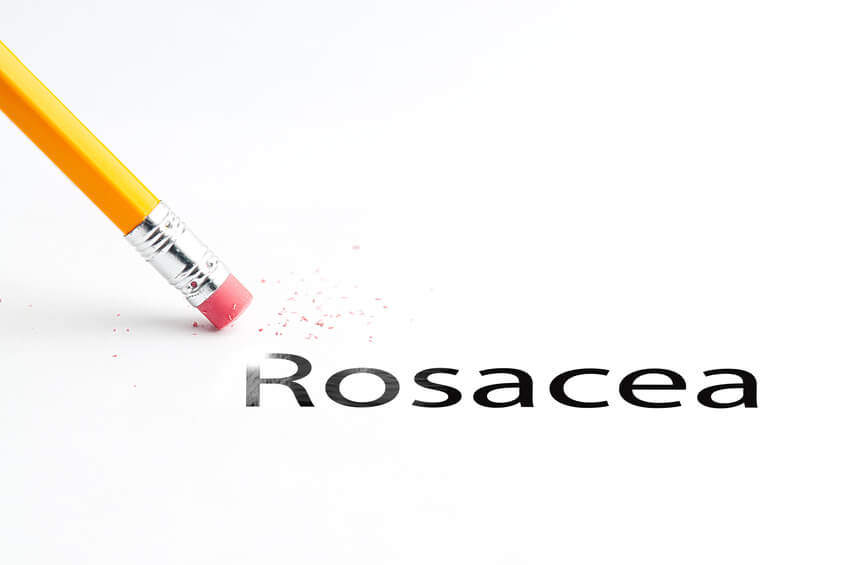 Kokosöl Rosacea