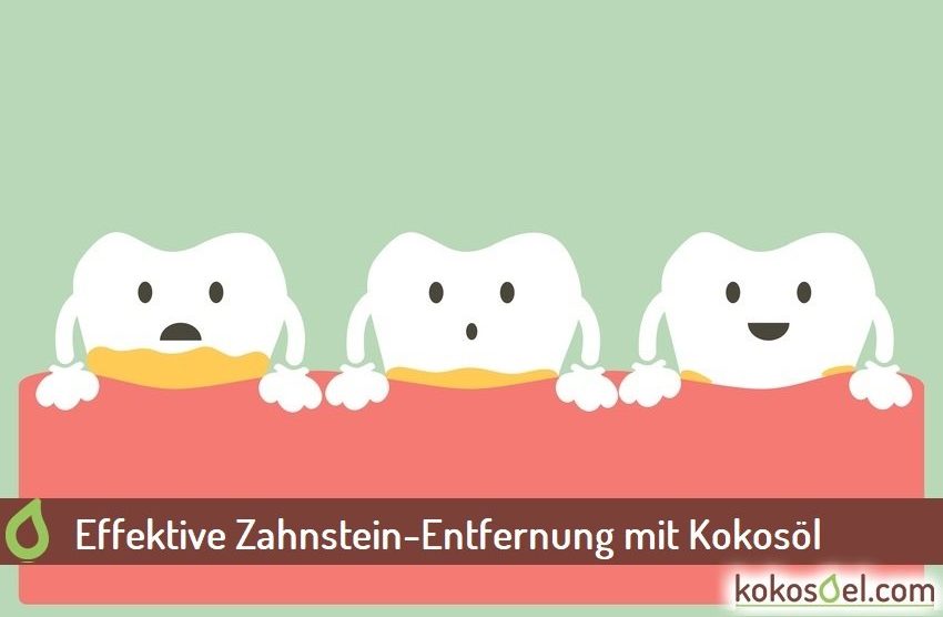 Mit Kokosöl Zahnstein entfernen Die sanfte Methode der Zahnpflege