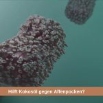 hilft kokosöl bei affenpocken